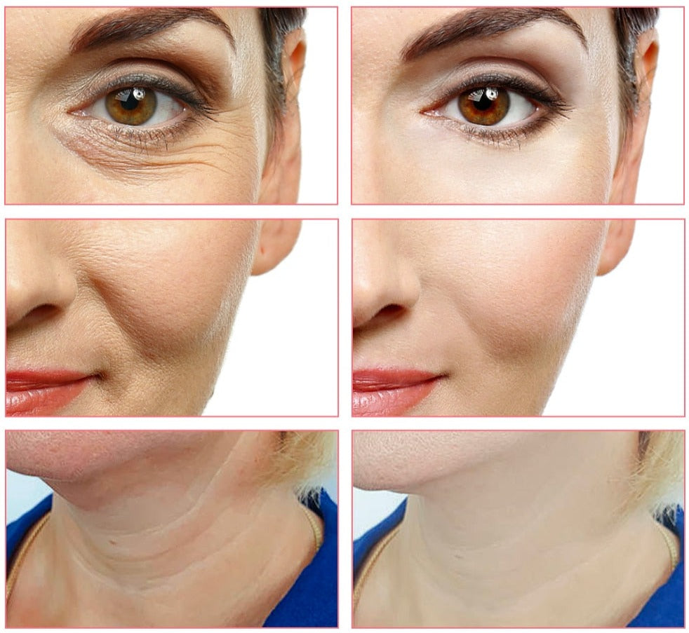 5-in-1 Facial EMS Rejuvenation Beauty Device